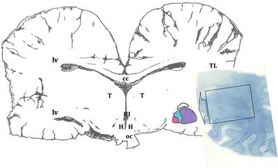 The amygdaloid body of the family Delphinidae: a morphological study of its central nucleus through calbindin-D28k